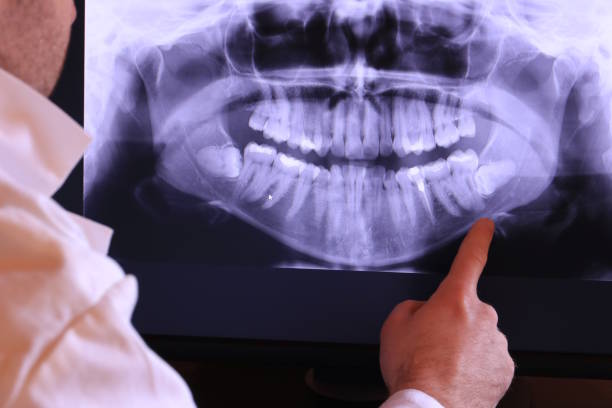 Best Emergency Tooth Extraction in Trinidad, CO